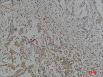 STAT1 Rabbit pAb Antibody