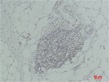 TNF α Rabbit pAb Antibody