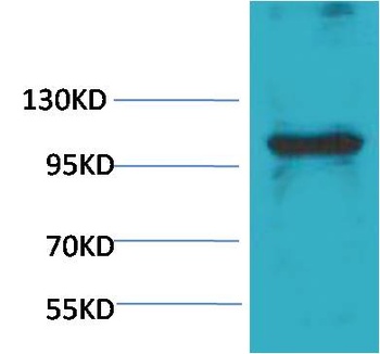 eEF1A2 binding protein Rabbit pAb Antibody