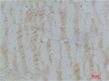 eEF1A2 binding protein Rabbit pAb Antibody