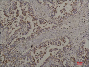 Flotillin-2 Rabbit pAb Antibody