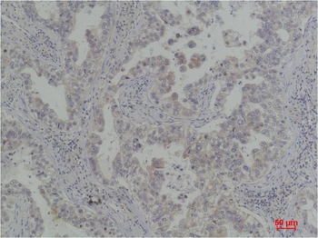 Bcl-Xl Rabbit pAb Antibody