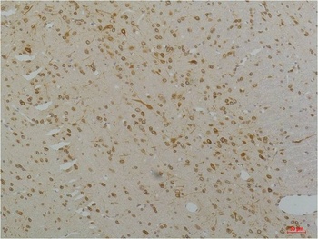 Cav1.2 Rabbit pAb Antibody