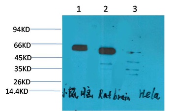 CCKBR Rabbit pAb Antibody