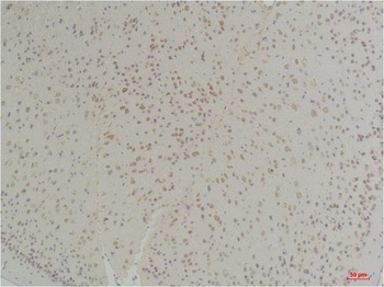 Connexin-26 Rabbit pAb Antibody