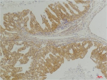 CXCR4 Rabbit pAb Antibody