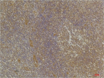 CXCR4 Rabbit pAb Antibody