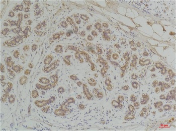 EphA1 Rabbit pAb Antibody