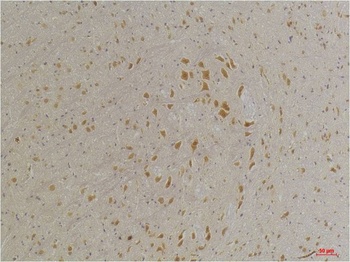 GABA A Receptor α4 Rabbit pAb Antibody