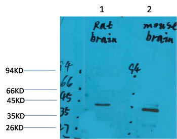GALR2 Rabbit pAb Antibody