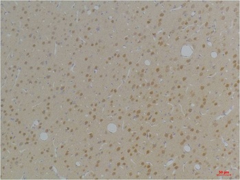 KVβ1 Rabbit pAb Antibody
