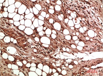 VEGF Rabbit pAb Antibody