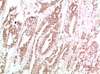 VEGF Rabbit pAb Antibody