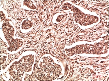 NM23A Rabbit pAb Antibody