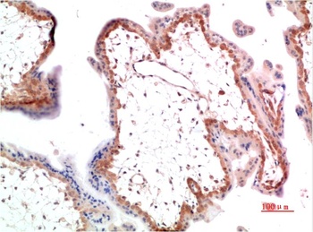 NM23A Rabbit pAb Antibody