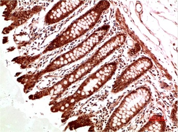 ATM Rabbit pAb Antibody