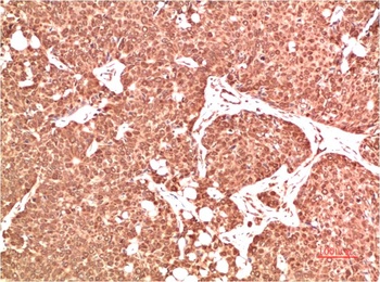 ATM Rabbit pAb Antibody