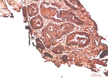 ATM Rabbit pAb Antibody