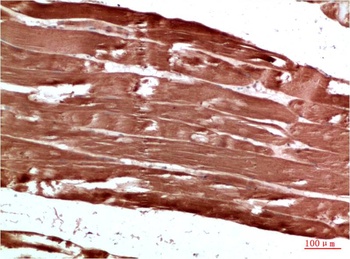 AMPK γ1 Rabbit pAb Antibody