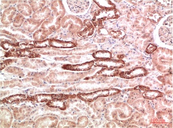 AMPK γ1 Rabbit pAb Antibody