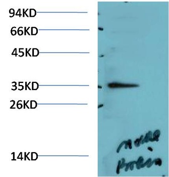 AMPK γ1 Rabbit pAb Antibody