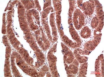 ERK1/2 Rabbit pAb Antibody