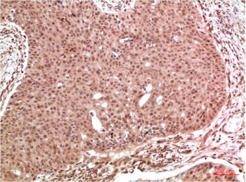 ERK1/2 Rabbit pAb Antibody