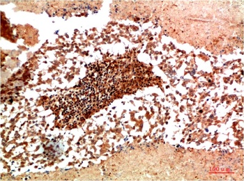 JAK1 Rabbit pAb Antibody