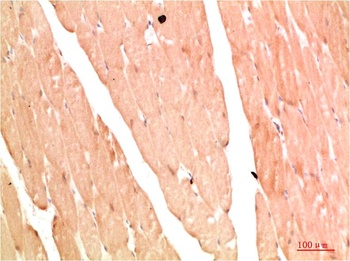 NBR1 Rabbit pAb Antibody