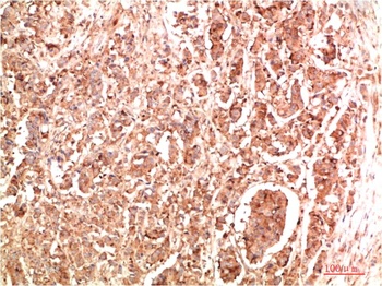NBR1 Rabbit pAb Antibody