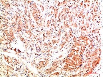 ERK1 Rabbit pAb Antibody