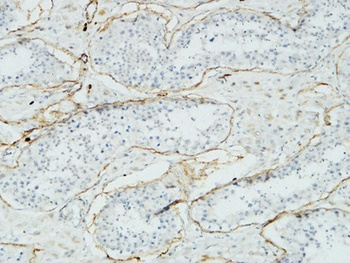 Acrosin rabbit pAb Antibody