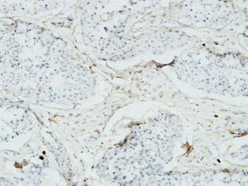 Acrosin rabbit pAb Antibody