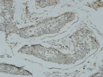 Acrosin rabbit pAb Antibody