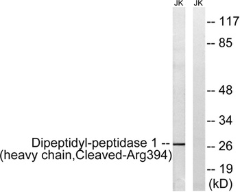 Cleaved-Cathepsin C HC (R394) rabbit pAb Antibody