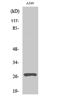 Cleaved-Cathepsin D HC (L169) rabbit pAb Antibody