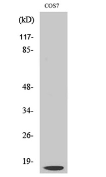 Cleaved-Cathepsin D LC (G65) rabbit pAb Antibody