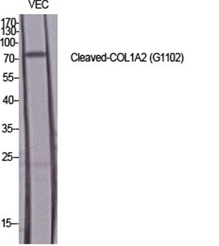 Cleaved-COL1A2 (G1102) rabbit pAb Antibody