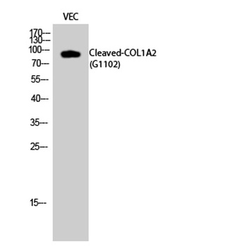 Cleaved-COL1A2 (G1102) rabbit pAb Antibody
