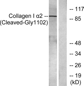 Cleaved-COL1A2 (G1102) rabbit pAb Antibody