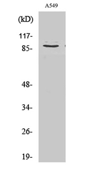 Cleaved-COL3A1 (G1221) rabbit pAb Antibody