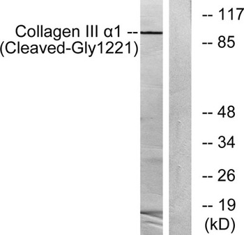 Cleaved-COL3A1 (G1221) rabbit pAb Antibody