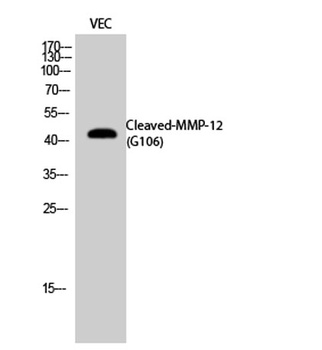 Cleaved-MMP-12 (G106) rabbit pAb Antibody