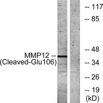 Cleaved-MMP-12 (G106) rabbit pAb Antibody