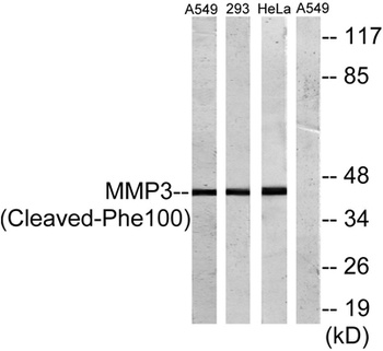 Cleaved-MMP-3 (F100) rabbit pAb Antibody