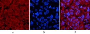 p53 (Di Methyl Lys370) rabbit pAb Antibody