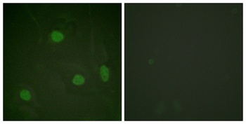 Histone H3 (Acetyl Lys23) rabbit pAb Antibody