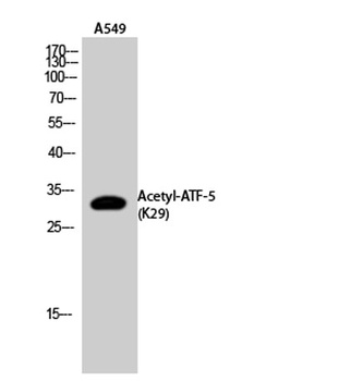 ATF-5 (Acetyl Lys29) rabbit pAb Antibody