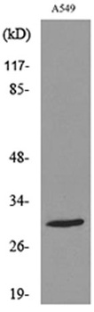 ATF-5 (Acetyl Lys29) rabbit pAb Antibody