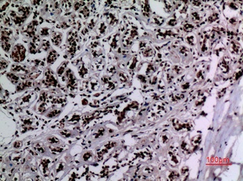 HSP 90 (Acetyl Lys292/284) rabbit pAb Antibody